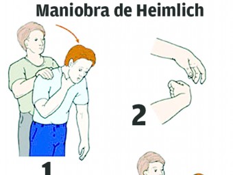 Els passos per realitzar la maniobra de Heimlich: una tècnica de primers auxilis per desobstruir el conducte respiratori E.P